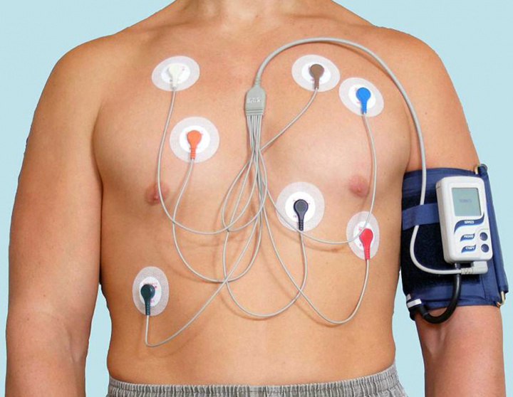 Холтер-мониторинг – эффективная проверка состояния сердца